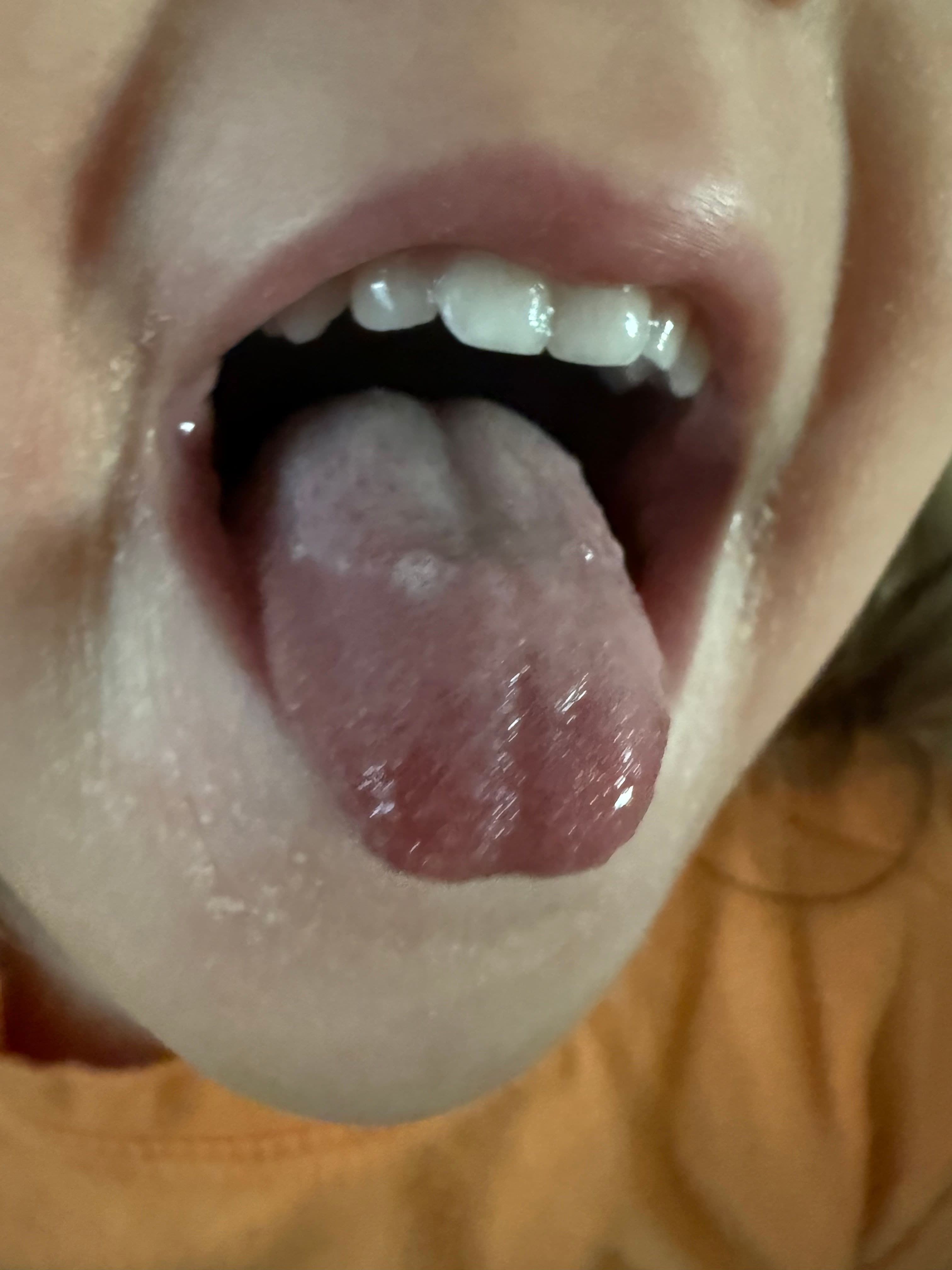 intake_tongue — Week 0