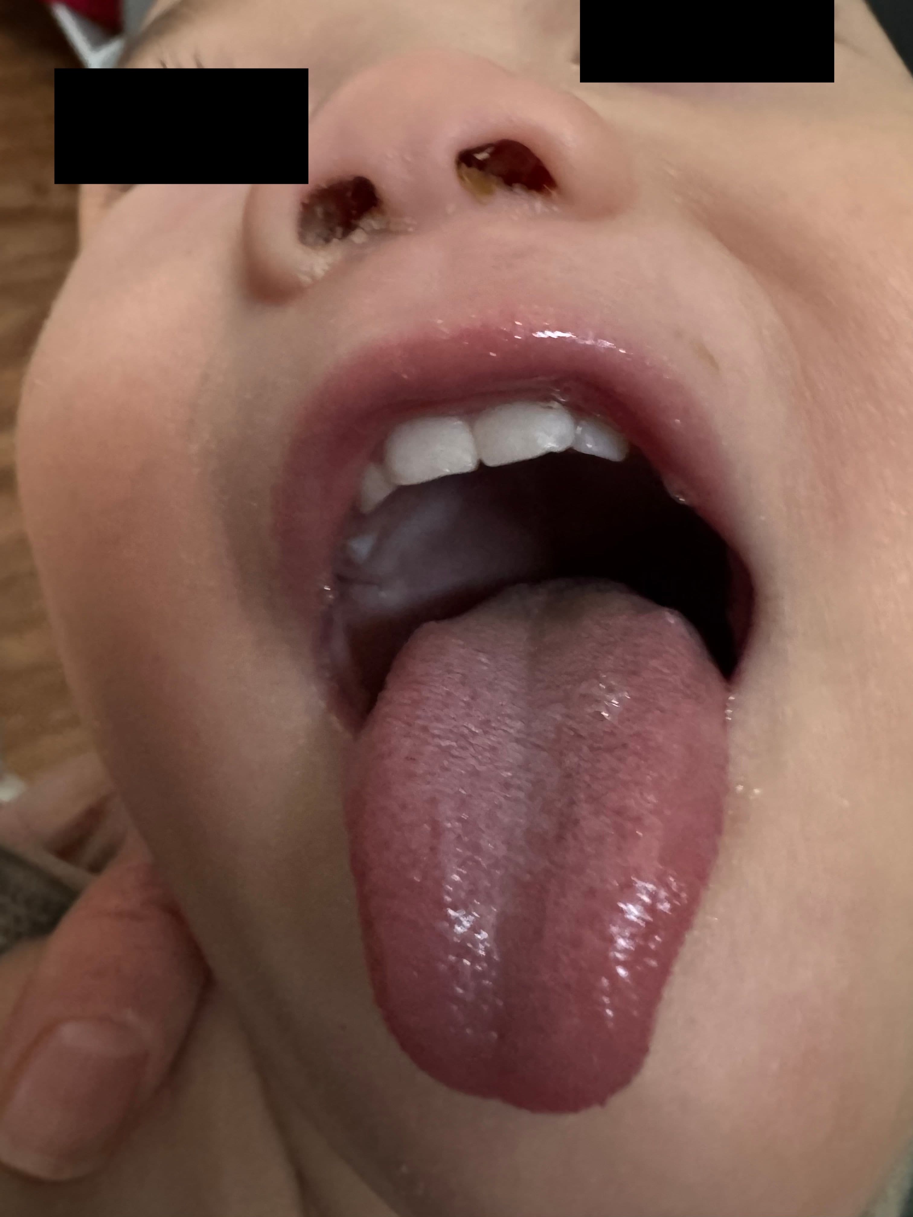 intake_tongue — Week 0
