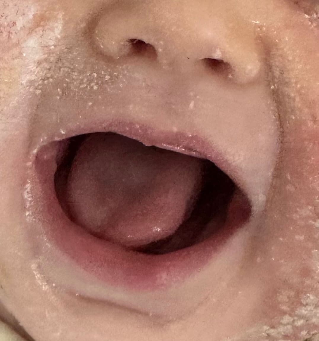 intake_tongue — Week 0