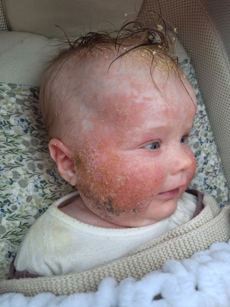 Poppy before — intake