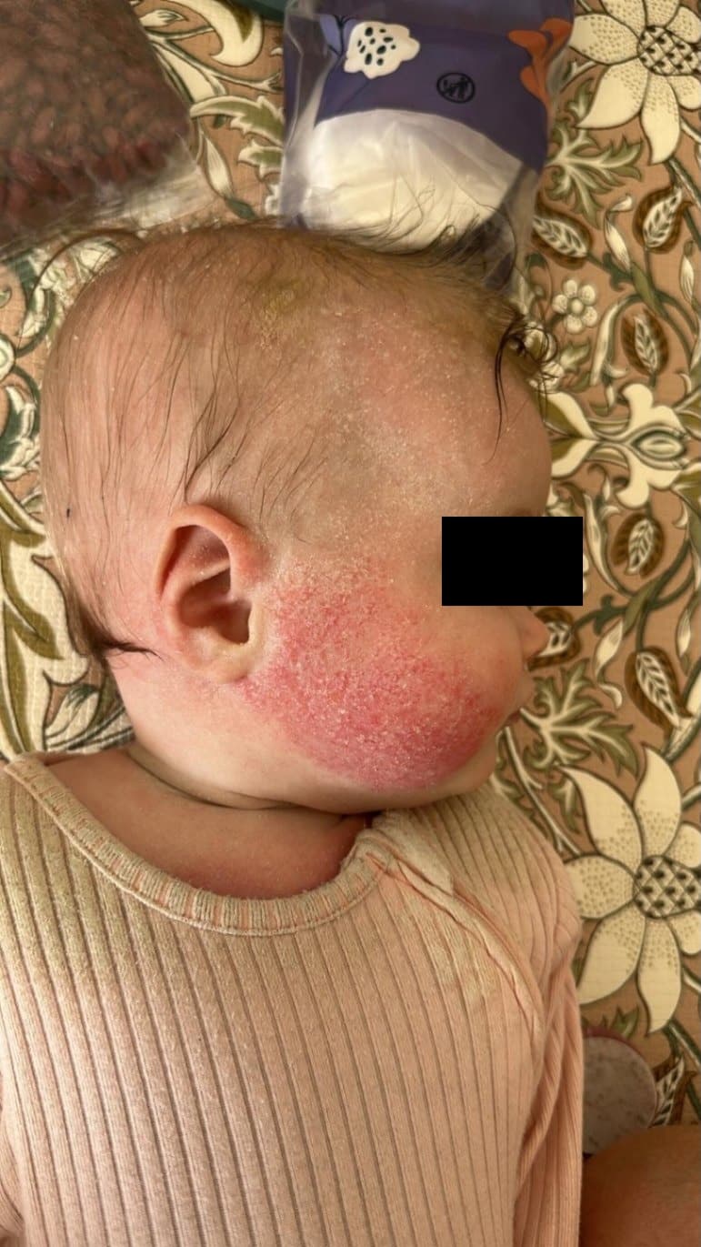 timeline — Week 2