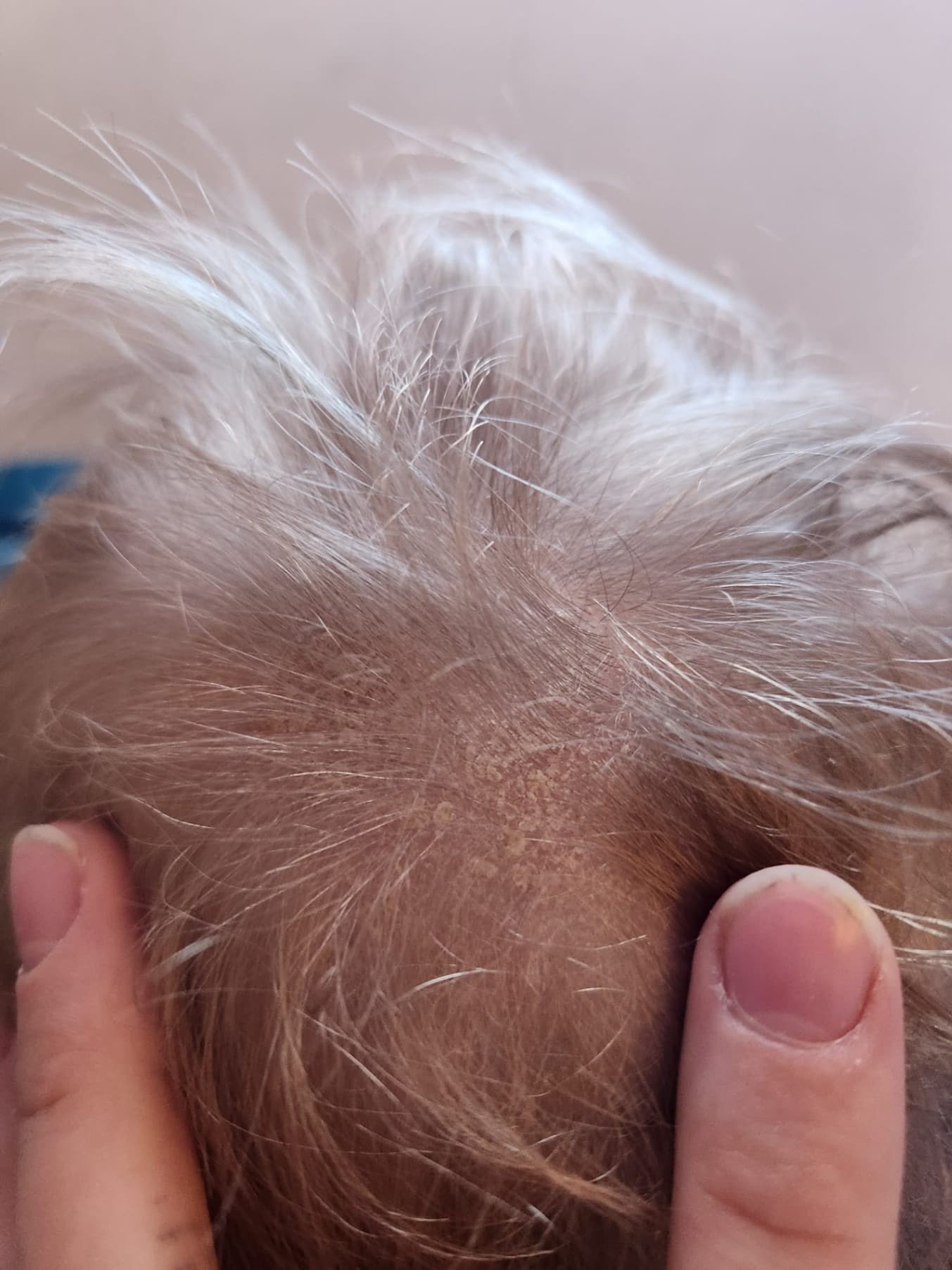 timeline — Week 3